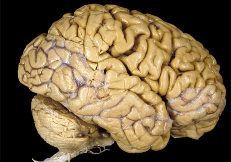 File:Brain2.jpg