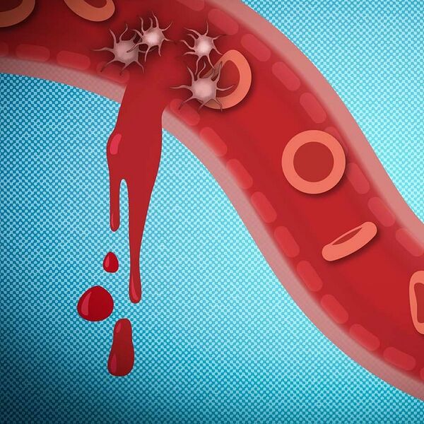 File:868 nanoparticles.jpg
