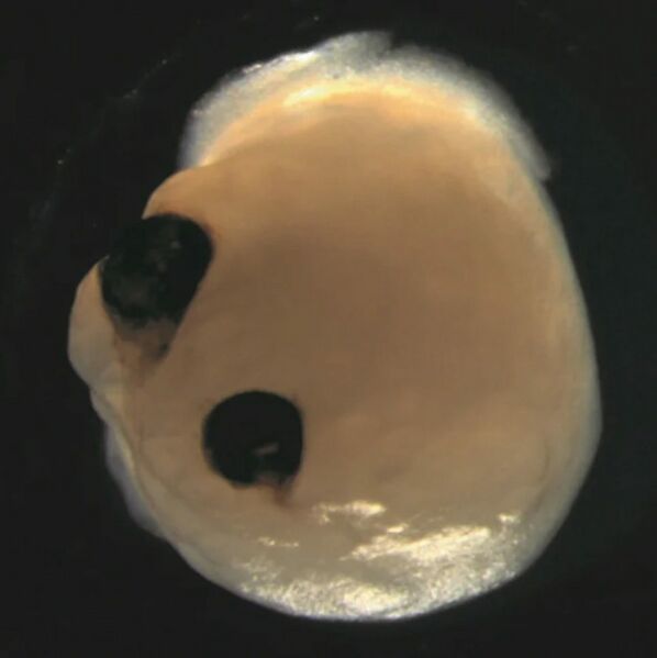 File:841 Brain-organoids-eyes.jpg