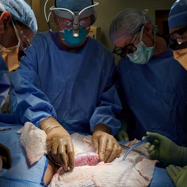 File:850 Pig kidney.jpg